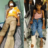 المليشيات الحوثية تستهدف طفلين بقذيفة هاون وتصيبهم بجروح متفرقة شمال الضالع